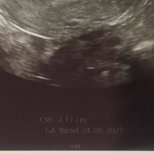 8w penebalan rahim, wajarkah?