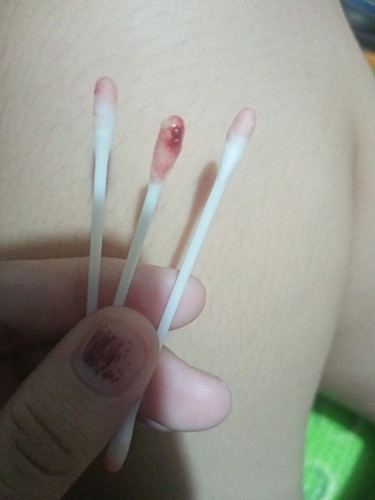 Ano po ba to at ano ginawa nyo??