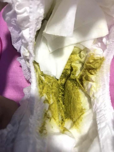 สอบถามแม่ๆค่ะ