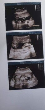 ช่วยเูหน่อยว่าได้ลูกสาวหรือลูกชาย