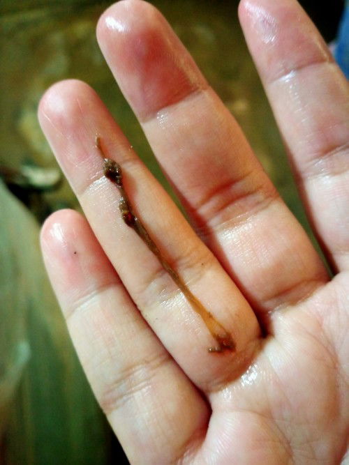 มีมูลออกมาแบบนี้อันตรายมั้ยค่ะ