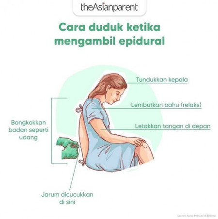 Cara epidural di cucuk ketika hamil nanti!