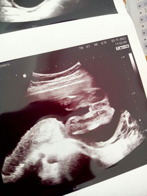 อยากถามแม่ๆค่ะ แบบนี่ ญ หรือ ช ค่ะ 😂