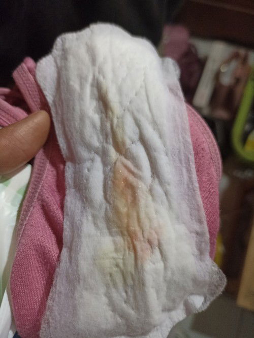 Usia 6w keluar flek bahayakah bunda?