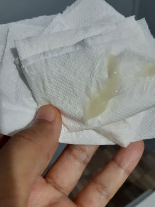 มูกสีเขียว