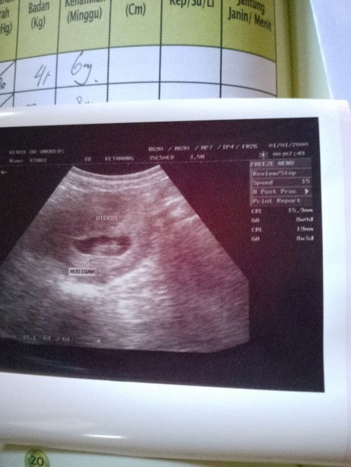 Bantu jawab ya bunda