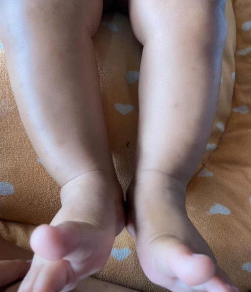 เรื่องร่างกายน้อง