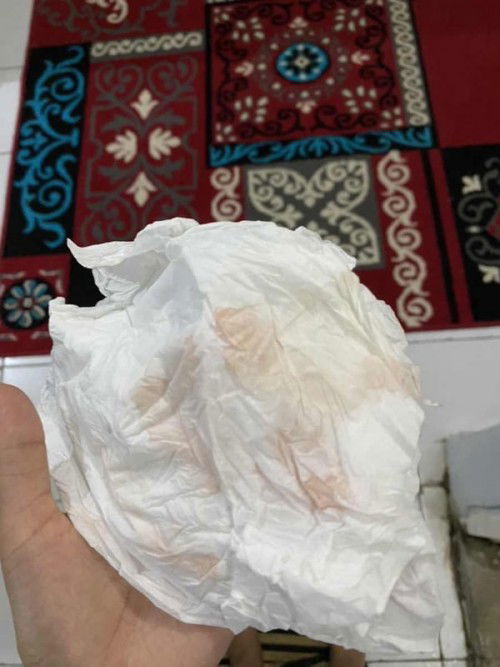 hamil 11 minggu pas pipis keluar darah