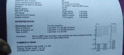 ขออนุญาตคุณแม่บ้านไหนลูกมีความเสี่ยงเป็นดาวน์บ้างครับ พอดีแฟนผมได้เอาเลือดไปตรวจ แล้วผลออกมาแบบนี้