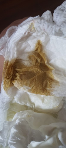 Diarrhea 3 months old baby