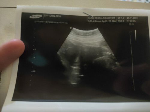 Tespek positif tapi begini?