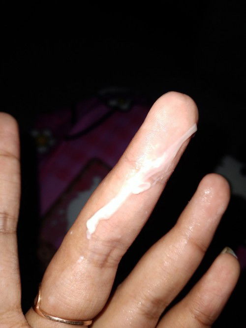 Keputihan normal apa tidak?