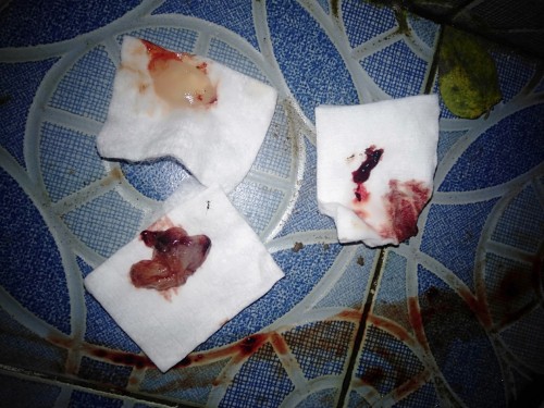 Janin ku udah gugur bunda untuk yg ke2x nya😔
Smg diberi keikhlasan dan kesabaran bg aku dan suami🤲