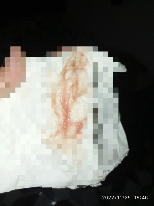 Mau tanya, ini keputihan atau flek tanda mau melahirkan? 
Sya hamil 38 wk.