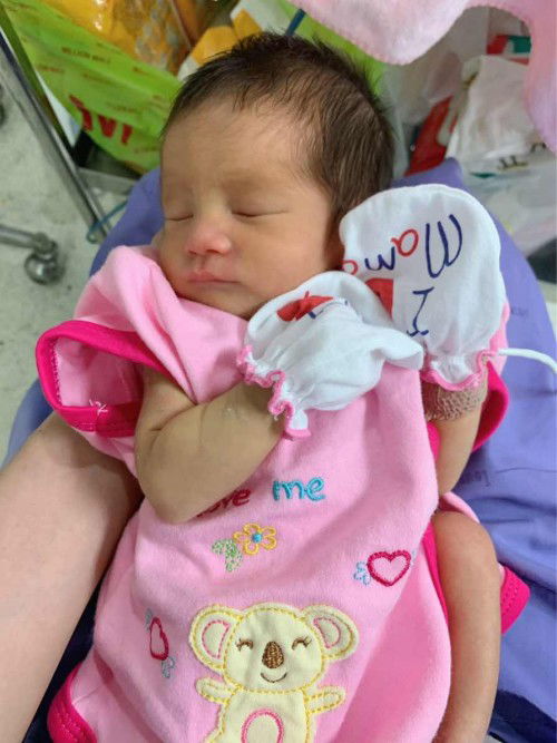 ต้าวตัวน้อยคลอดก่อนกำหนด