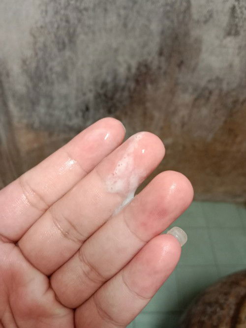 ตกขาวแบบนี้ผิดปกติไหมคะ ท้องแรกจ้า