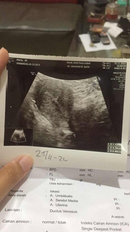 1 minggu dari dokter lepas jaringan.