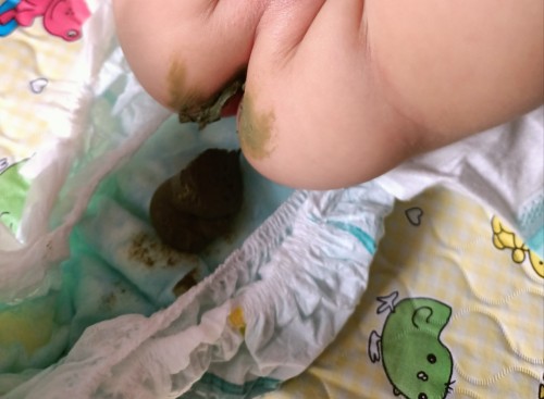 Normal po ba ganitong poop ni baby almost 4 months pure formula