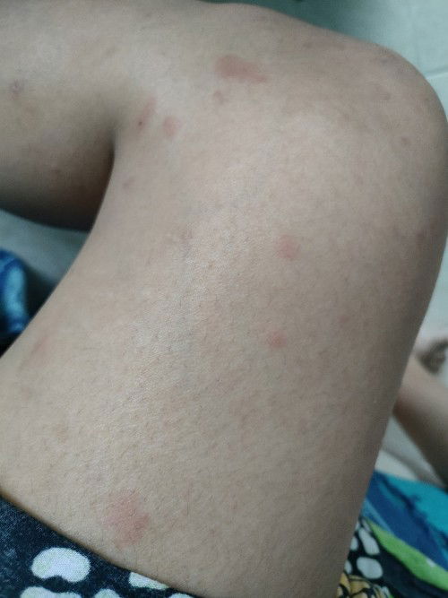 Adakah yang sama bund?