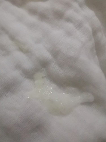 hello mga momsh ask ko kang delikado po ba ito naglungad si baby prang may kasmang plema