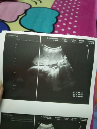 33+6 มาอวดรูปอัลตราซาวด์กันหน่อย
