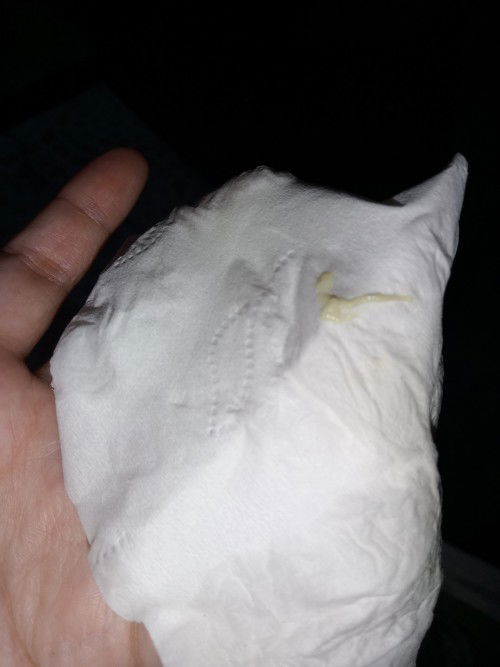 Discharge #16weeks & 1day