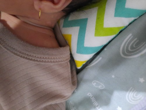 Bercak putih kemerahan di kulit bayi