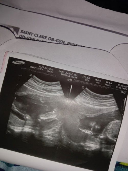 Ano sa tingin nyo mga mii?