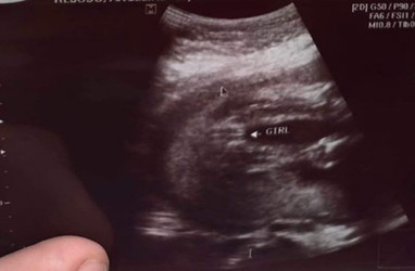 Gender ni baby