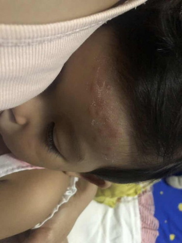 ตุ่มอะไรใครรู้บ้างช่วยทีค่ะกังวลมากๆ