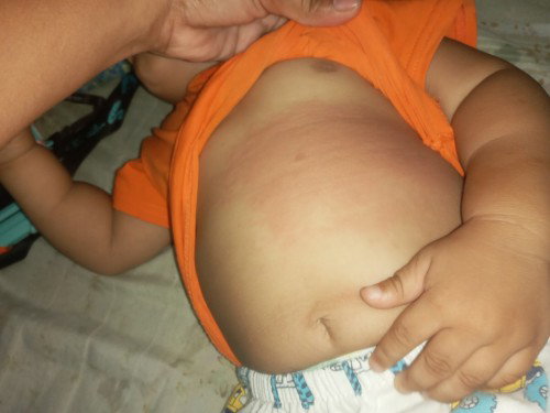 Ano po kaya to makati  panay kmot ng baby ko ??