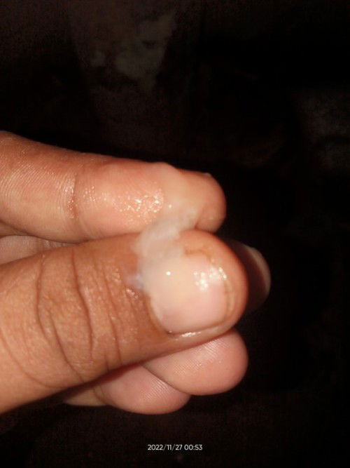 PASIN TABI PO 😊

Ganito po ba ang MUCUS PLUG.???
Clear po na parang jelly na may white color .