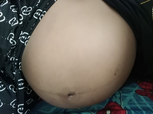 มีแม่ๆคนไหนท้องแฝดอยู่บ้างคะ?
