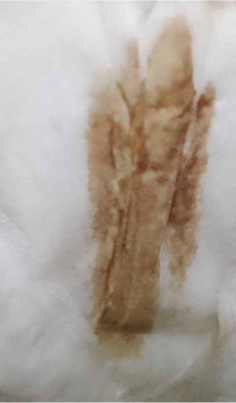 Discharge?