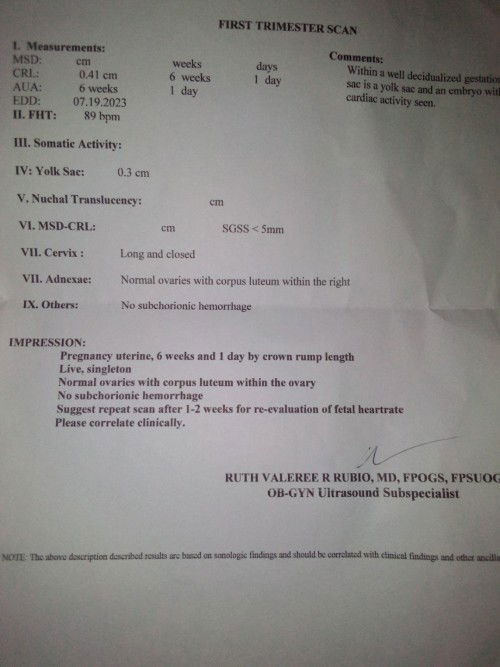 6 weeks and 4 days pregnant