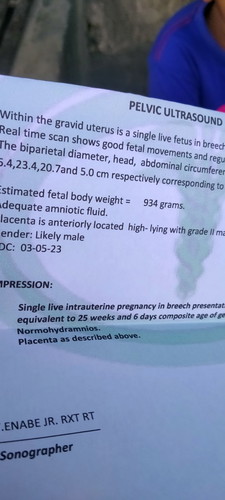 Sakto lang po kaya yung estimated fetal weight ni baby? 26weeks and 5days na po ako..