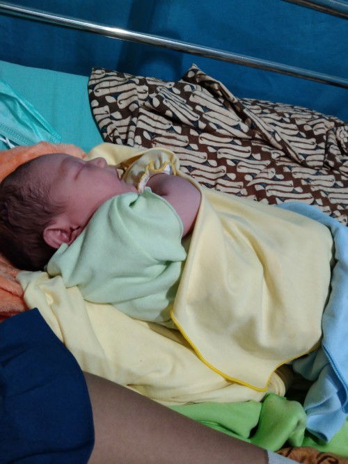 Alhamdulillah telah launching anak kedua kami normal bb 3,300 minim jaitan jenis kelamin perempuan😍