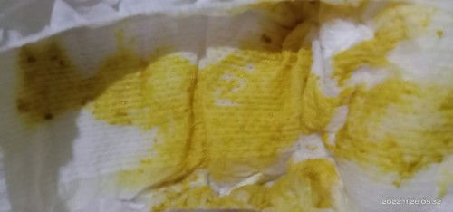 May diarrhea kaya c baby?