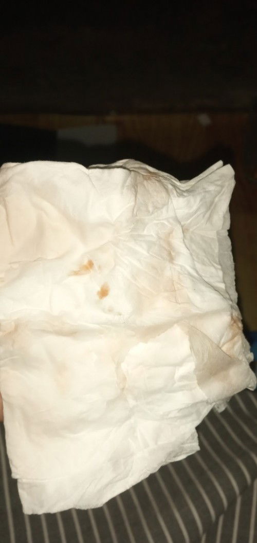 Bun mau tanya. Apakah kalau keluar cairan coklat seperti ini tanda mau melahirkan? . Saya hamil 39w