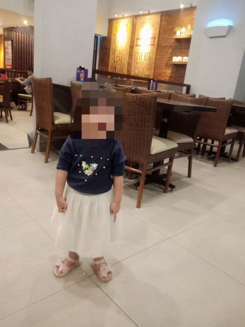 Telapak kaki bentuk V