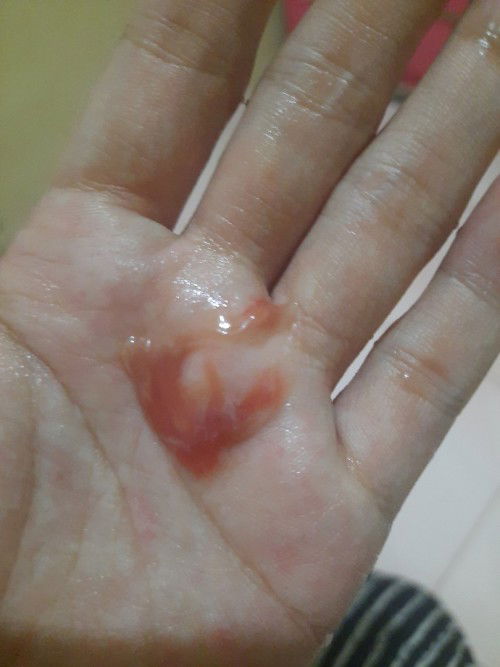 Sign na kaya to na manga2nak na ko? Pasintabi po s kumakain