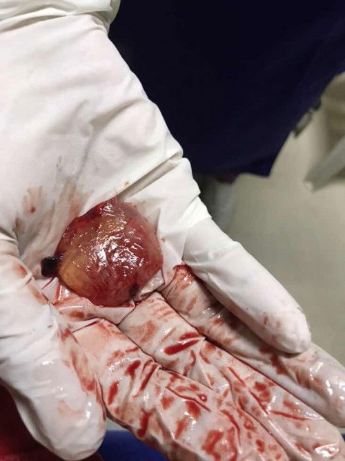 Mommies worry lang ako sa pagbubuntis ko ngayon nakunan kase ako last june. Ayan yung pic