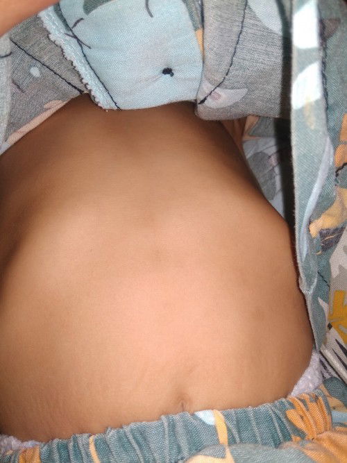 Bun normal gak sih kalo tulang di bagian perut sekelihatan itu, aku ibu baru takut ada yg salah 😭😭