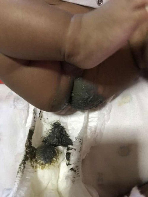 ขออนุญาตสอบถามแม่ๆบ้านอื่นหน่อยค่ะ