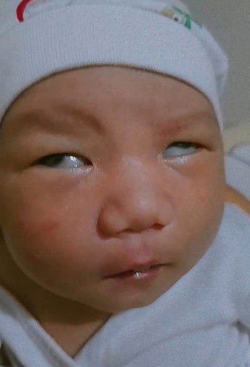 Normal po ba na tumitirik tirik ang mata ng baby 15days palang po sya