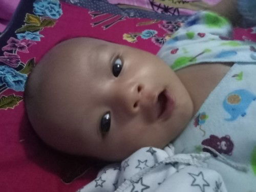 Kondisi kesehatan bayi