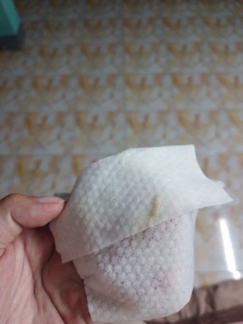 แบบนี้มูกใส หรือ ตกขาว