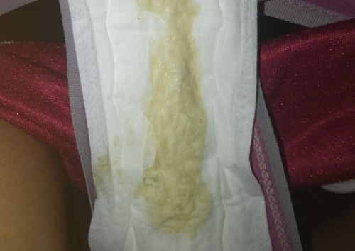 Greenish/yellowish Discharge