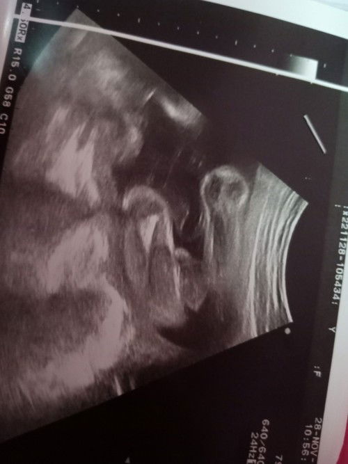 สอบถามแม่ๆ