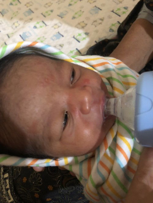 Kulit bayi usia 3hari  bintik2